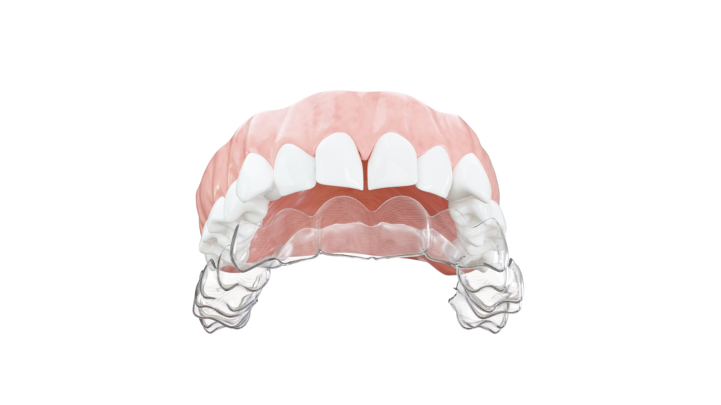 Unsichtbare Zahnschiene | Zahnmedizin Koblenz